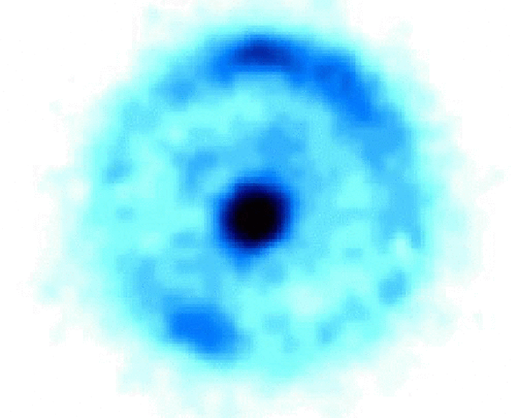 $\displaystyle {4GM\over R_E\,c^2}\,,$